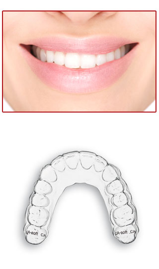 Die CLEAR-ALIGNER-Schiene ist klar und transparent, fast unsichtbar.